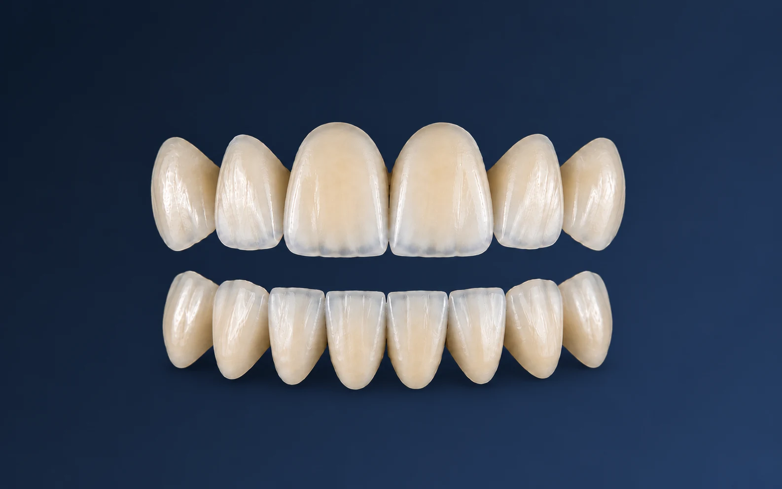 Prótesis fija de alta precisión y carillas estéticas en laboratorio dental Digitalis Málaga