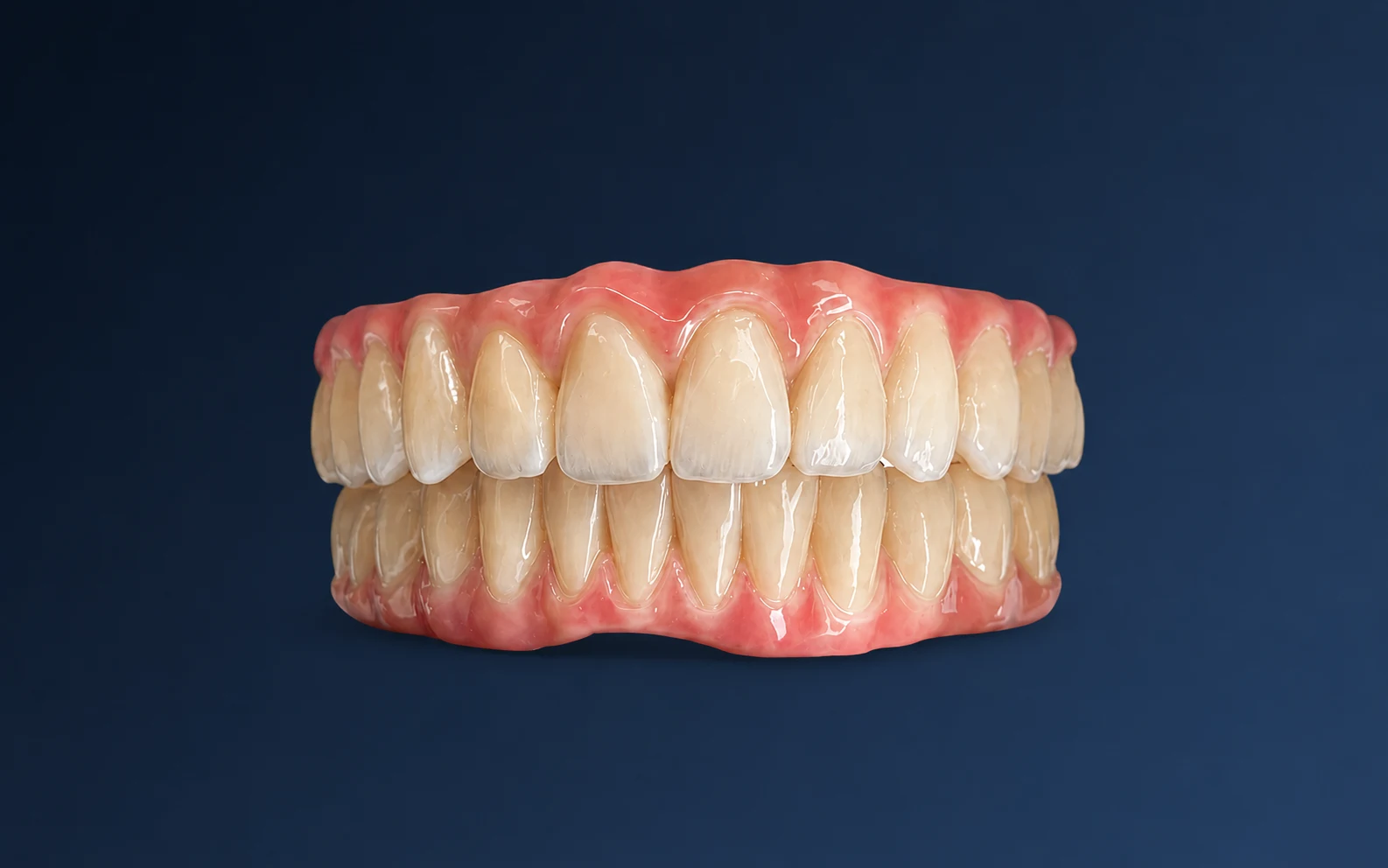 Estructura rehabilitadora Full Arch sobre implantes en zirconio fresado en Málaga