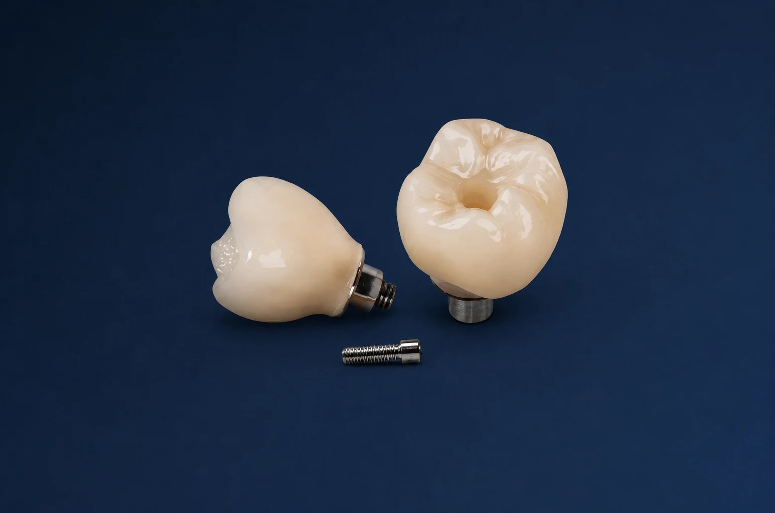 Prótesis dental atornillada sobre implantes con chimenea angulada fabricada en Málaga